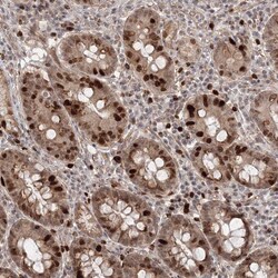 Invitrogen KIF20A Polyclonal Antibody 100 &mu;L; Unconjugated:Antibodies,