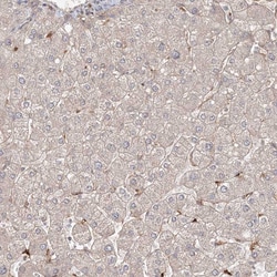 Invitrogen KIF20A Polyclonal Antibody 100 &mu;L; Unconjugated:Antibodies,