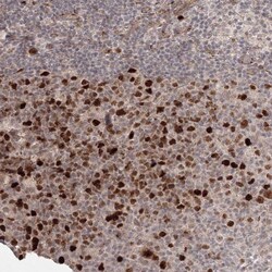 Invitrogen KIF20A Polyclonal Antibody 100 &mu;L; Unconjugated:Antibodies,