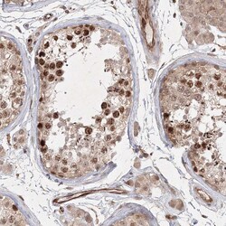 Invitrogen KIF20A Polyclonal Antibody 100 &mu;L; Unconjugated:Antibodies,