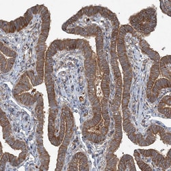 Invitrogen SNX2 Polyclonal Antibody 100 &mu;L; Unconjugated:Antibodies,