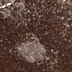 Invitrogen SNX2 Polyclonal Antibody 100 &mu;L; Unconjugated:Antibodies,