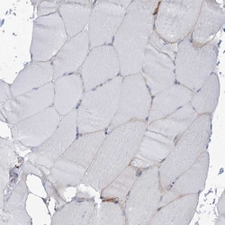 Invitrogen SNX2 Polyclonal Antibody 100 &mu;L; Unconjugated:Antibodies,