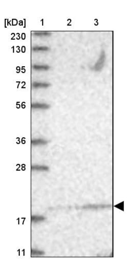 Invitrogen NCE2 Polyclonal Antibody 100 &mu;L; Unconjugated:Antibodies,