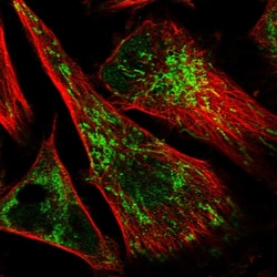 Invitrogen IMPA1 Polyclonal Antibody 100 &mu;L; Unconjugated:Antibodies,