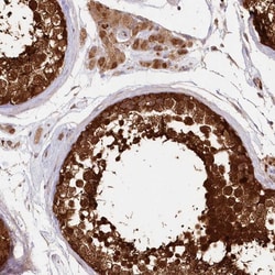 Invitrogen IMPA1 Polyclonal Antibody 100 &mu;L; Unconjugated:Antibodies,