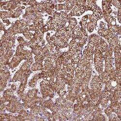 Invitrogen AADAT Polyclonal Antibody 100 &mu;L; Unconjugated:Antibodies,