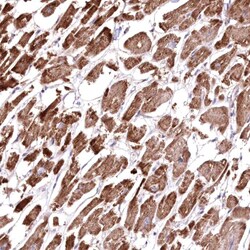 Invitrogen HADHB Polyclonal Antibody 100 &mu;L | Buy Online | Invitrogen&trade; | Fisher Scientific