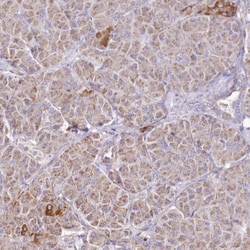 Invitrogen HADHB Polyclonal Antibody 100 &mu;L | Buy Online | Invitrogen&trade; | Fisher Scientific