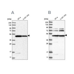 Invitrogen HADHB Polyclonal Antibody 100 &mu;L | Buy Online | Invitrogen&trade; | Fisher Scientific