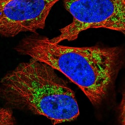 Invitrogen SLC16A12 Polyclonal Antibody 100 &mu;L | Buy Online | Invitrogen&trade; | Fisher Scientific