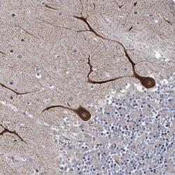 Invitrogen SHIP2 Polyclonal Antibody 100 &mu;L; Unconjugated:Antibodies,
