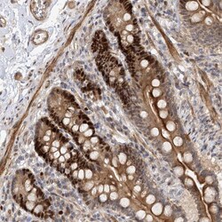 Invitrogen PIK3C2A Polyclonal Antibody 100 &mu;L; Unconjugated:Antibodies,