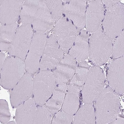 Invitrogen CD8 alpha Polyclonal Antibody 100 &mu;L; Unconjugated:Antibodies,