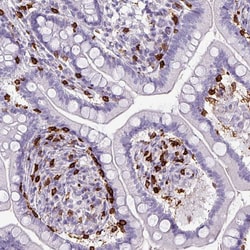 Invitrogen CD8 alpha Polyclonal Antibody 100 &mu;L; Unconjugated:Antibodies,