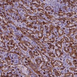 Invitrogen CD8 alpha Polyclonal Antibody 100 &mu;L; Unconjugated:Antibodies,