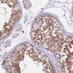 Invitrogen DDX4 Polyclonal Antibody 100 &mu;L; Unconjugated:Antibodies,