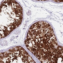 Invitrogen DDX4 Polyclonal Antibody 100 &mu;L; Unconjugated:Antibodies,