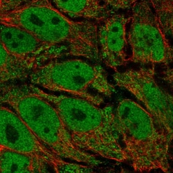 Invitrogen AKR1E2 Polyclonal Antibody 100 &mu;L; Unconjugated:Antibodies,