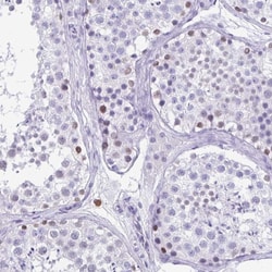 Invitrogen SPATA16 Polyclonal Antibody 100 &mu;L; Unconjugated:Antibodies,