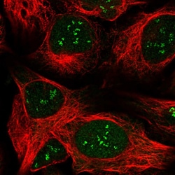 Invitrogen LPIN1 Polyclonal Antibody 100 &mu;L; Unconjugated:Antibodies,