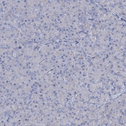 Invitrogen LPIN1 Polyclonal Antibody 100 &mu;L; Unconjugated:Antibodies,