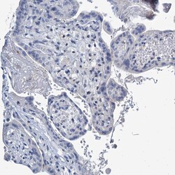 Invitrogen LPIN1 Polyclonal Antibody 100 &mu;L; Unconjugated:Antibodies,