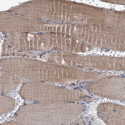 Invitrogen LPIN1 Polyclonal Antibody 100 &mu;L; Unconjugated:Antibodies,