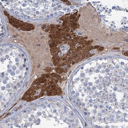 Invitrogen LPIN1 Polyclonal Antibody 100 &mu;L; Unconjugated:Antibodies,