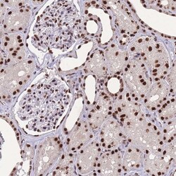 Invitrogen PRP19 Polyclonal Antibody 100 &mu;L; Unconjugated:Antibodies,