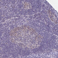 Invitrogen CAS Polyclonal Antibody 100 &mu;L | Buy Online | Invitrogen&trade; | Fisher Scientific