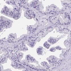 Invitrogen CAS Polyclonal Antibody 100 &mu;L | Buy Online | Invitrogen&trade; | Fisher Scientific