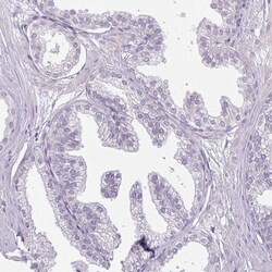 Invitrogen CAS Polyclonal Antibody 100 &mu;L; Unconjugated:Antibodies,