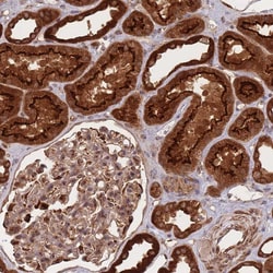 Invitrogen PRKAR2A Polyclonal Antibody 100 &mu;L; Unconjugated:Antibodies,