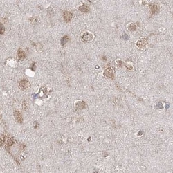 Invitrogen eIF3a Polyclonal Antibody 100 &mu;L; Unconjugated:Antibodies,