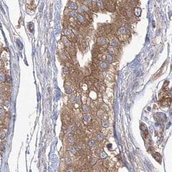 Invitrogen eIF3a Polyclonal Antibody 100 &mu;L; Unconjugated:Antibodies,