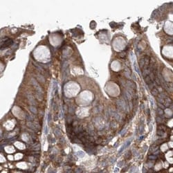 Invitrogen eIF3a Polyclonal Antibody 100 &mu;L; Unconjugated:Antibodies,