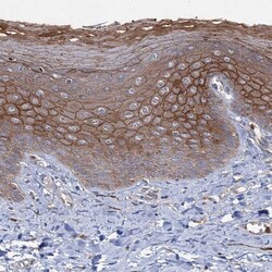 Invitrogen PTPN3 Polyclonal Antibody 100 &mu;L; Unconjugated:Antibodies,
