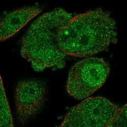 Invitrogen Adenosine Kinase Polyclonal Antibody 100 &mu;L; Unconjugated:Antibodies,