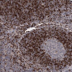 Invitrogen Adenosine Kinase Polyclonal Antibody 100 &mu;L; Unconjugated:Antibodies,