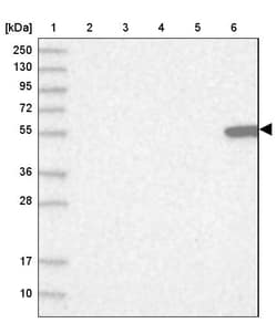 Invitrogen Citrate Synthase Polyclonal Antibody 100 &mu;L; Unconjugated:Antikörper