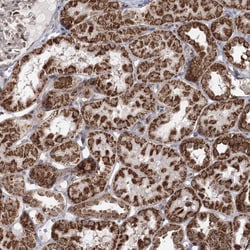 Invitrogen PDHX Polyclonal Antibody 100 &mu;L; Unconjugated:Antibodies,