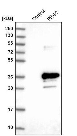 Invitrogen PRG2 Polyclonal Antibody 100 &mu;L | Buy Online | Invitrogen&trade; | Fisher Scientific
