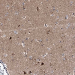 Invitrogen Syntaxin 6 Polyclonal Antibody 100 &mu;L; Unconjugated:Antibodies,