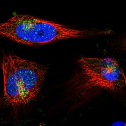 Invitrogen Syntaxin 6 Polyclonal Antibody 100 &mu;L | Buy Online | Invitrogen&trade; | Fisher Scientific