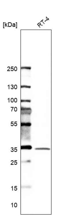 Invitrogen Syntaxin 6 Polyclonal Antibody 100 &mu;L | Buy Online | Invitrogen&trade; | Fisher Scientific