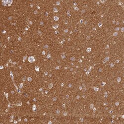 Invitrogen MADD Polyclonal Antibody 100 &mu;L | Buy Online | Invitrogen&trade; | Fisher Scientific