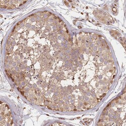 Invitrogen MADD Polyclonal Antibody 100 &mu;L | Buy Online | Invitrogen&trade; | Fisher Scientific