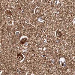 Invitrogen TOLLIP Polyclonal Antibody 100 &mu;L | Buy Online | Invitrogen&trade; | Fisher Scientific