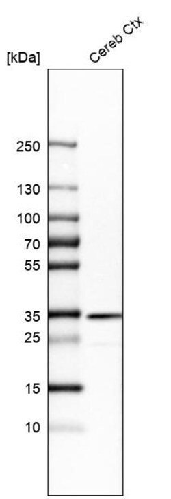 Invitrogen TOLLIP Polyclonal Antibody 100 &mu;L | Buy Online | Invitrogen&trade; | Fisher Scientific